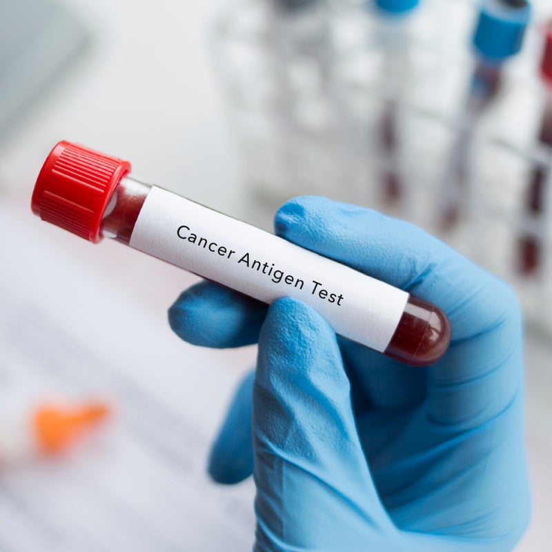 Cancer Screening at Home - Male