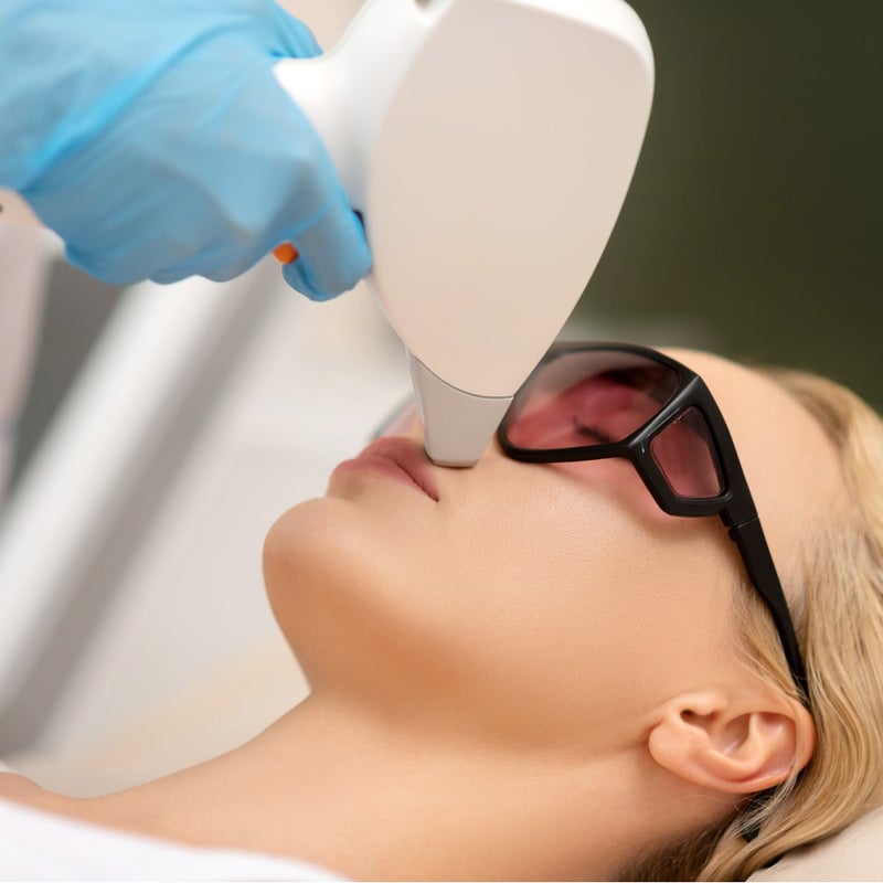 Laser Hair Removal (LHR) – Chin & Upper Lips (3 Sessions)