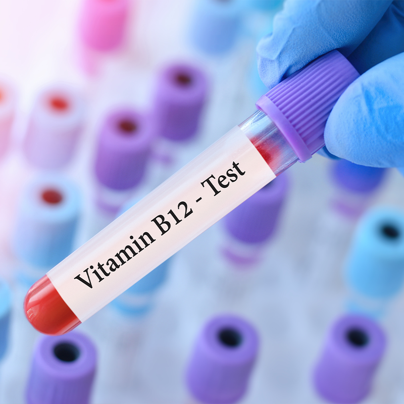 Vitamin B12 Test