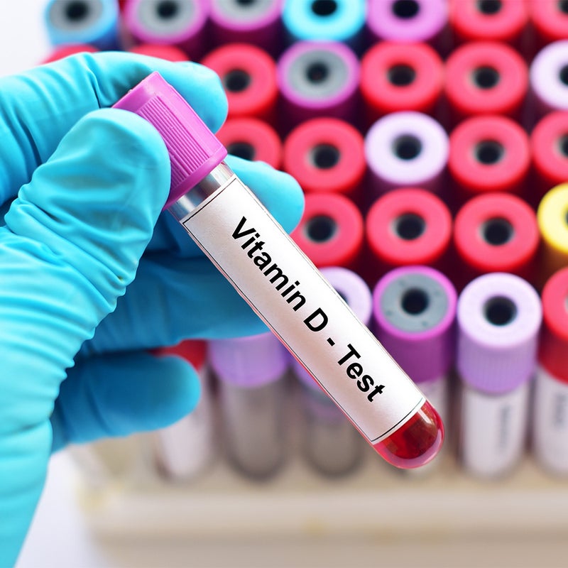 Vitamin D Test