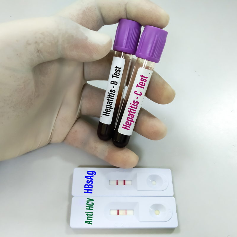 Hepatitis Screening Package
