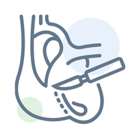 Cardio Thoracic Surgery